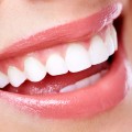 Cosmetic dentistry